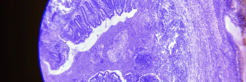 Clinical Case of Splenic Torsion in a Doberman with Generalized Lymphoma