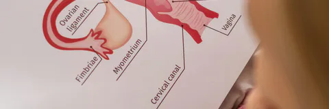 Assessment of Polycystic Ovarian Syndrome Complications, and Drug Prescribing Patterns in Tertiary Care Hospital