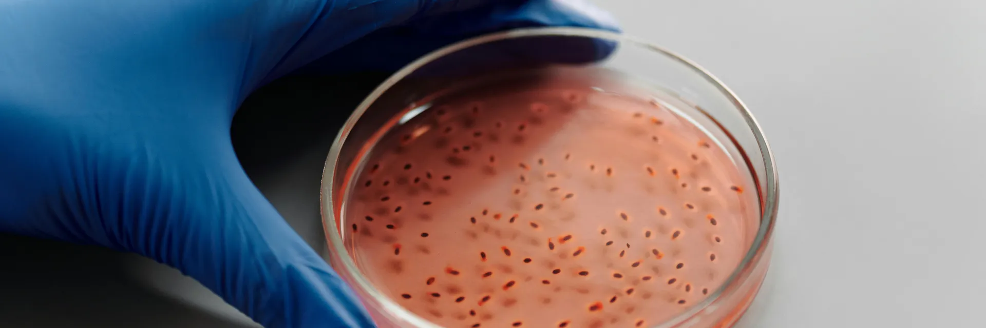 Prevalence of anemia among pregnant women admitted to the maternity at Guelendeng District Hospital in Chad Banner