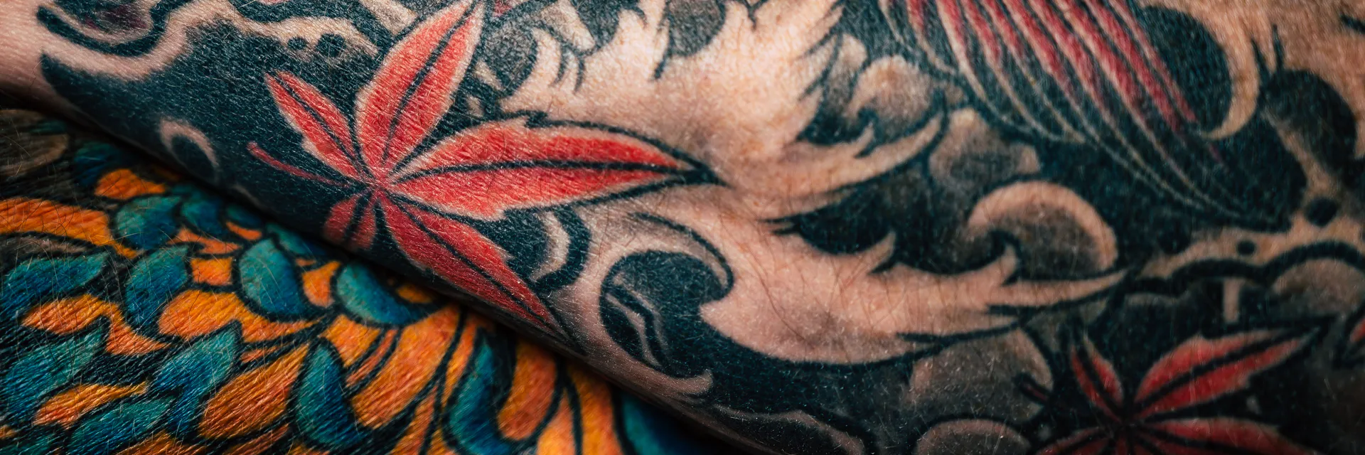 Tattoo as a Possible Trigger for Autoimmune Syndrome Induced by Adjuvants Banner
