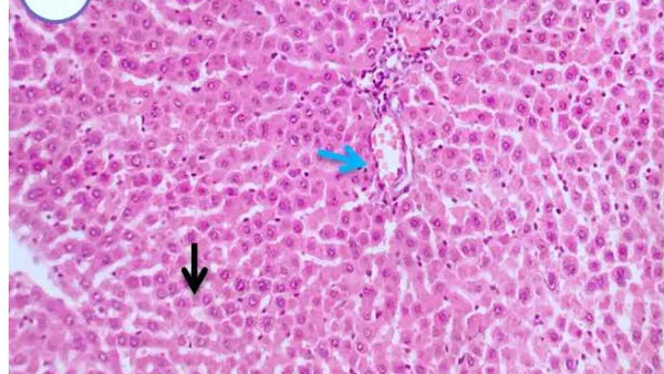 Possible Protective Role of Ginger Extract on Methomyl Induced Hepatotoxicity in Adult Male Albino Rats