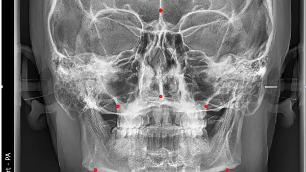 Evalution of Frontal Cephalometric Indicators of Upper and Lower Jaw Relationship in Representatives of the Uzbek Population