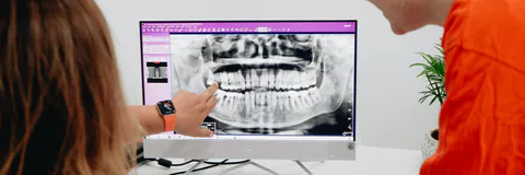 Concomitant Extraction of Wisdom Teeth with Bilateral Sagittal Split Osteotomy(BSSO): A Case Series