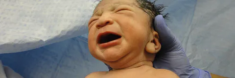 Emergency Peripartum Hysterectomy in a Tertiary Care Centre and Medical College Of Ranchi, Jharkhand, India : A Retrospective Study