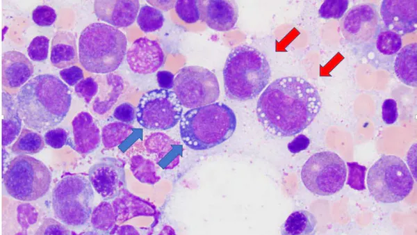 Copper Deficiency: An Overlooked Cause of Anemia and Leucopenia