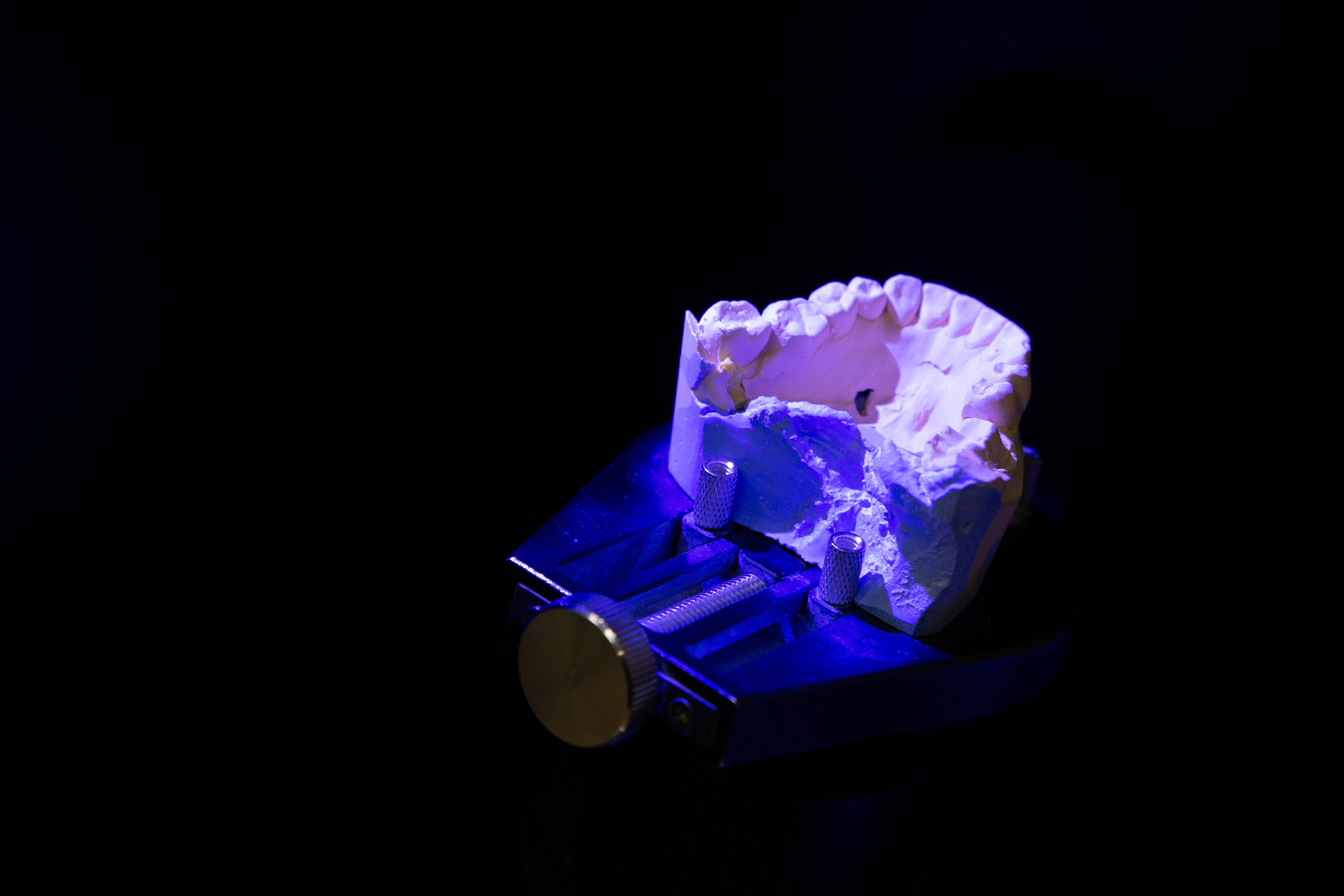 Finite Element Method and Applications in Dentistry –A Review