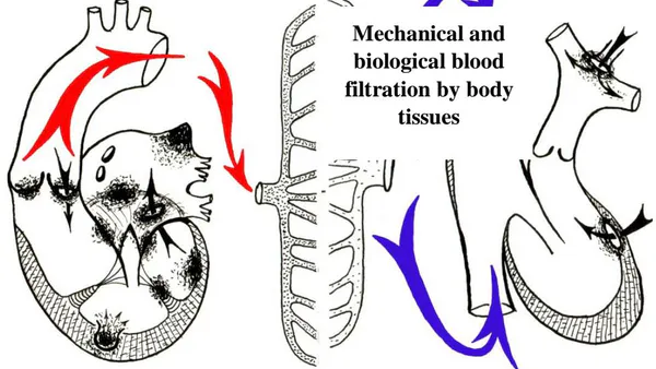 Significance of the Prevalence of Arterial Bacteremia over Venous Bacteremia in the Etiological Diagnosis of Intracardiac Infection