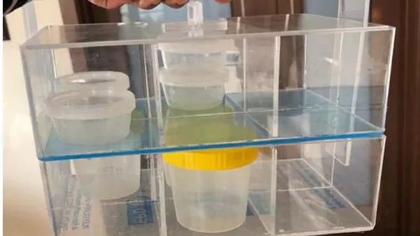 Improvement on Packaging and Referencing Tuberculosis Samples – Experience in Zambezia, Mozambique