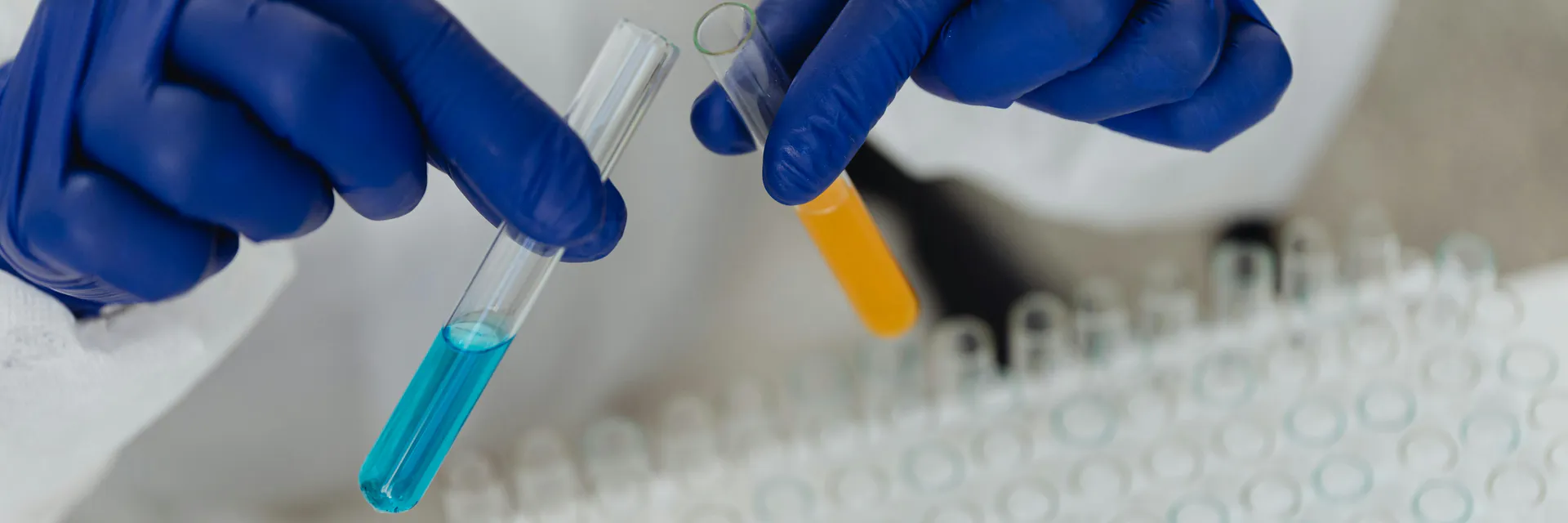 Changes in Total Protein Level in Human Female Saliva during Ovulatory Functions and Metabolic Disorders Banner