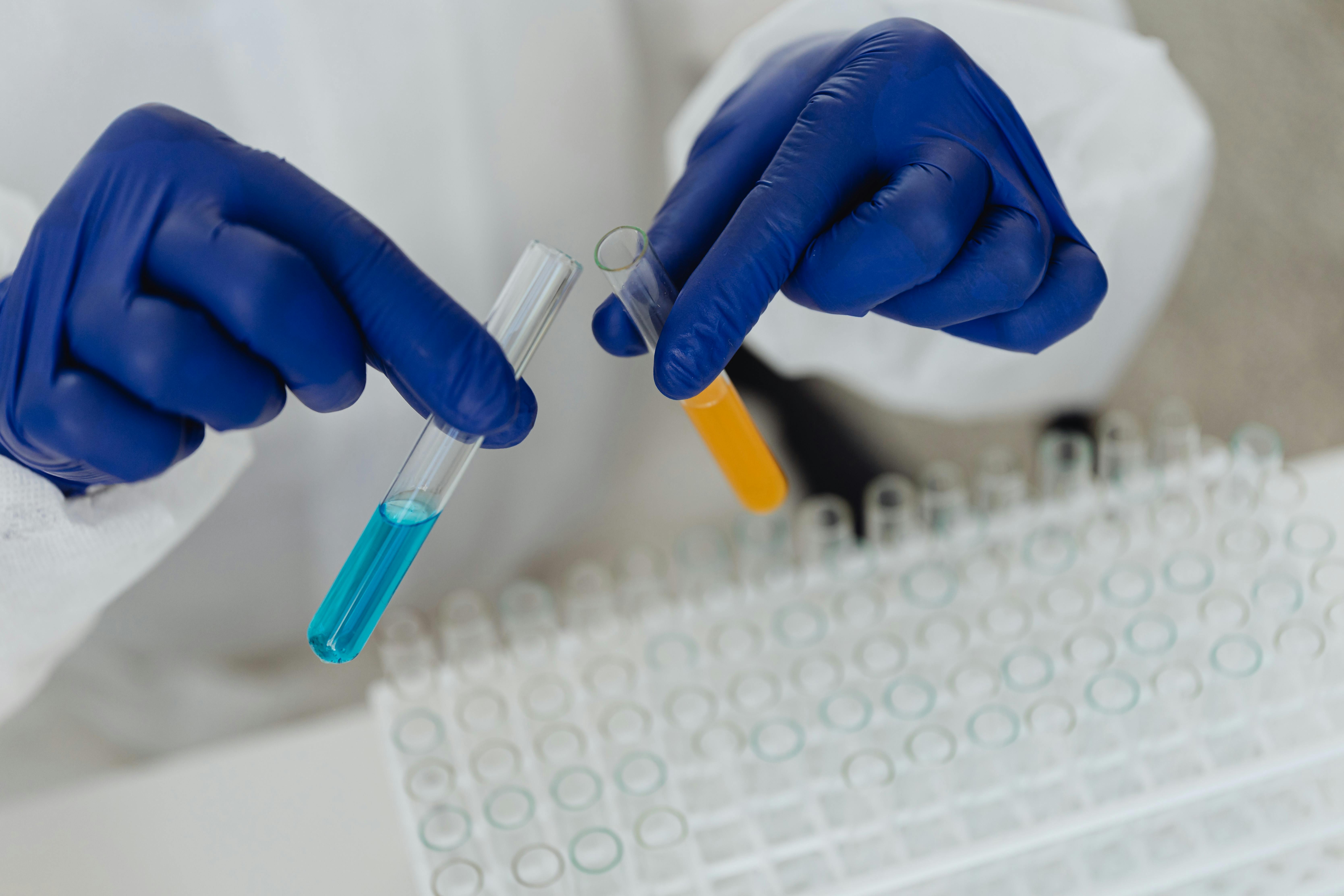 Changes in Total Protein Level in Human Female Saliva during Ovulatory Functions and Metabolic Disorders