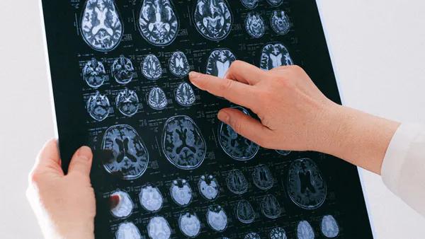 Posterior Reversible Encephalopathy Syndrome Secondary to Arterial Hypertension: A Case Report from Lubumbashi, Democratic Republic of Congo