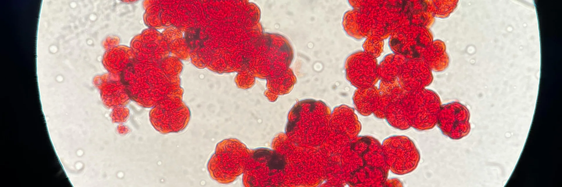 Recurrent Urinary Tract Infections Associated with Chlamydia trachomatis Banner