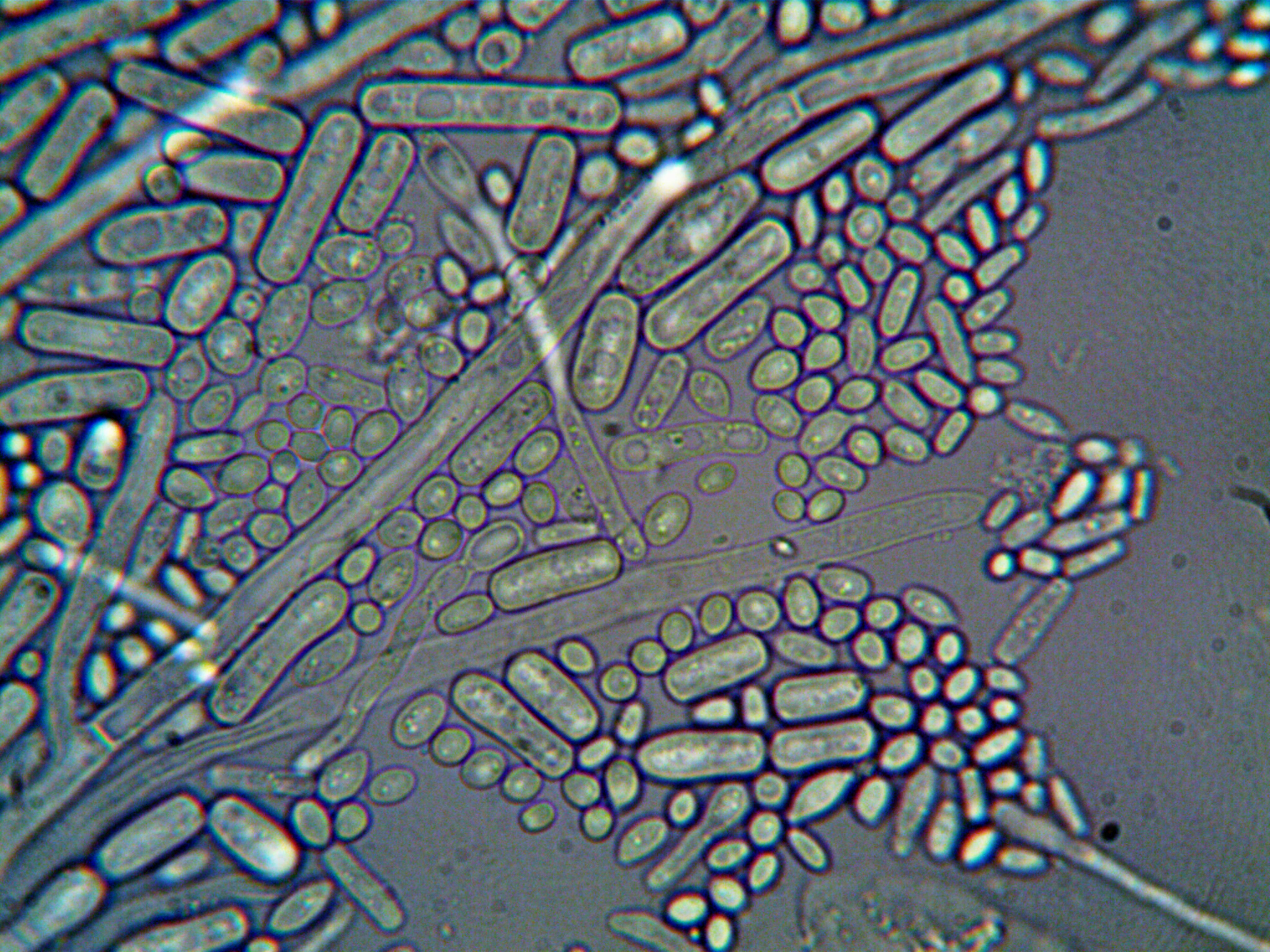 Recurrent Urinary Tract Infections Associated with Chlamydia trachomatis