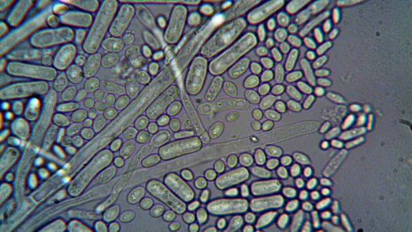 Recurrent Urinary Tract Infections Associated with Chlamydia trachomatis