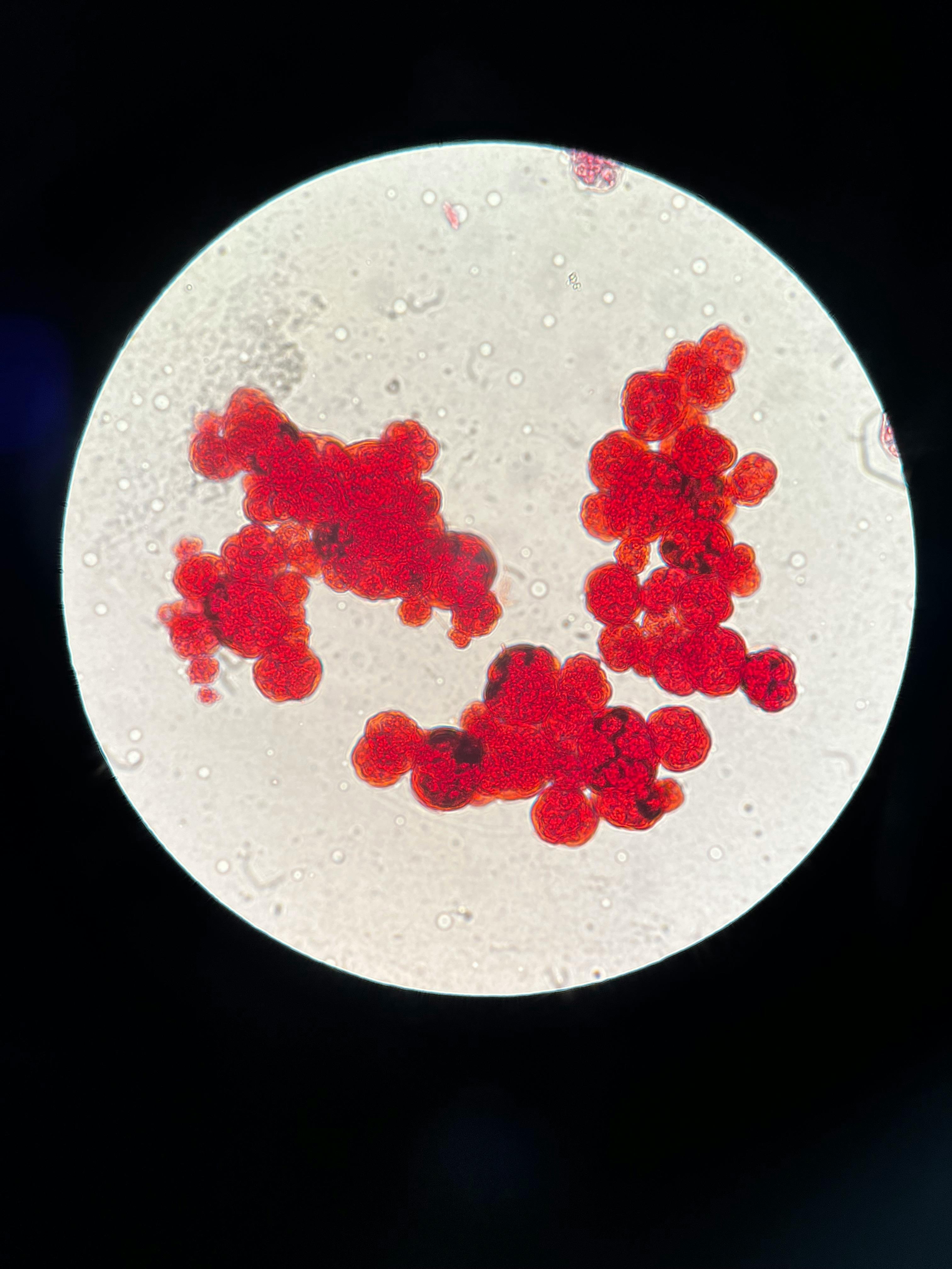 Recurrent Urinary Tract Infections Associated with Chlamydia trachomatis Banner