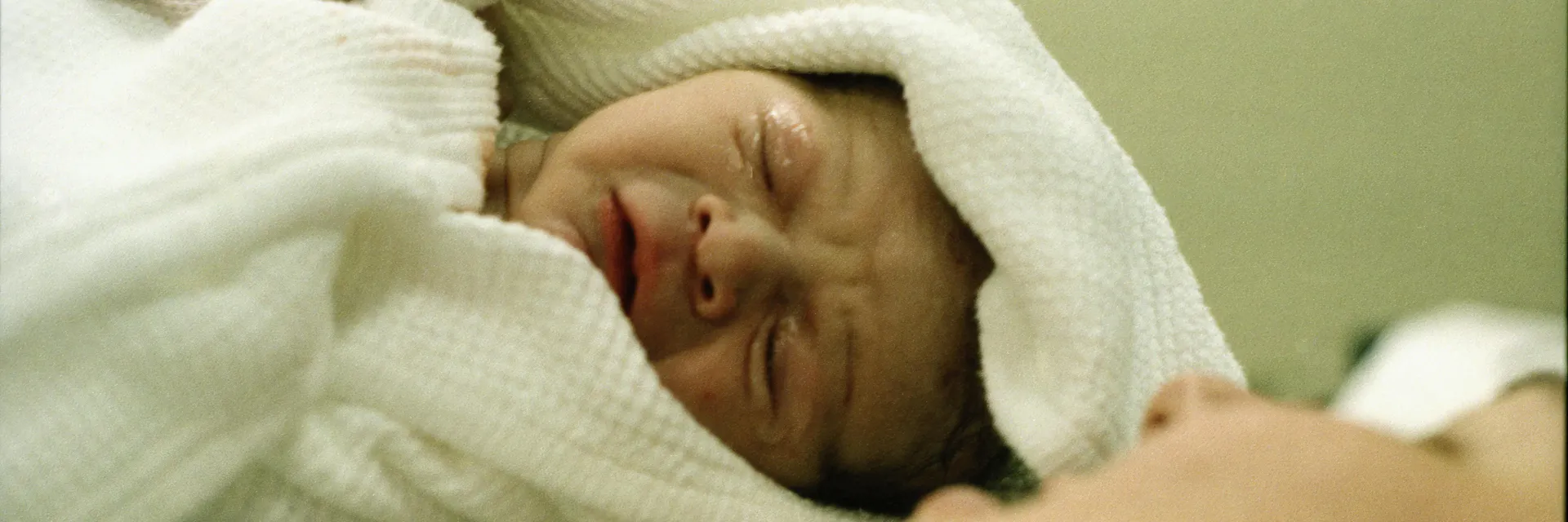 Maternal and Perinatal Outcomes in Twins Conceived Spontaneously Versus by ART – A Prospective Observational Study Banner