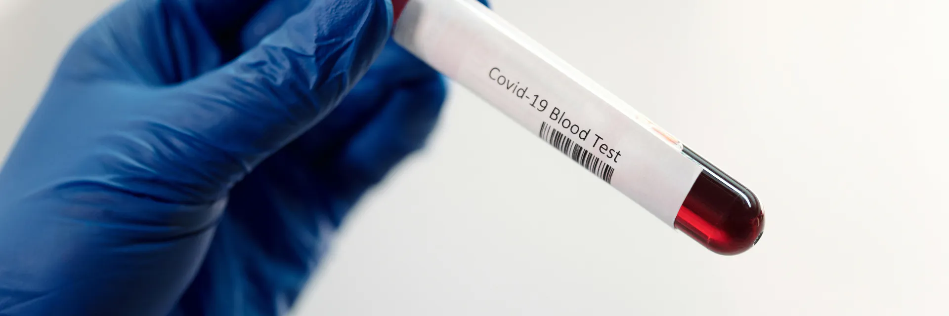 Hepatitis C Virus Infected Human Megakaryocytes and Platelets: Intra- and Extracellular Evaluation Banner