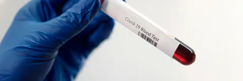 Hepatitis C Virus Infected Human Megakaryocytes and Platelets: Intra- and Extracellular Evaluation