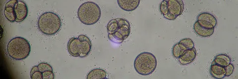 Wonder Findings of Number of Cells in a Body Including Sexual Cells, Remedy of Corona Virus, Increase of Memory, and other Cells by Couple System