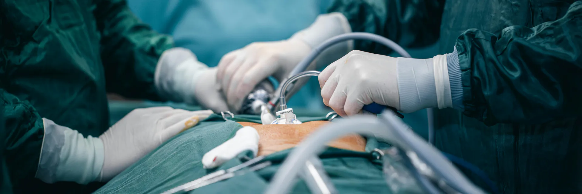 Surgical Management of Coexisting Trigeminal  Neuralgia, Hemifacial Spasm, and Glossopharyngeal Neuralgia by Microasterional  Approacha Banner