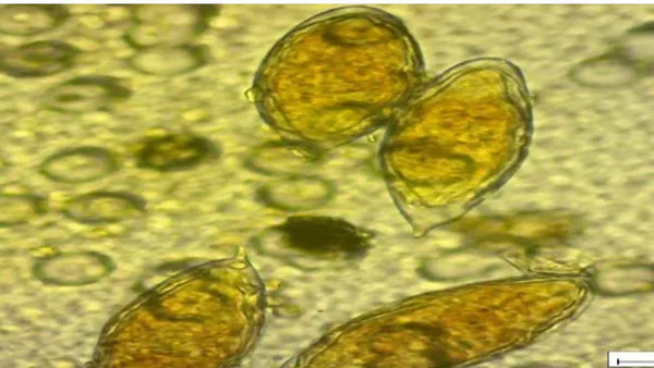 Traditional Approaches on Morbidity and Case Management of Urinary Schistosoma Infection in Rural Communities of Ogun State, Nigeria