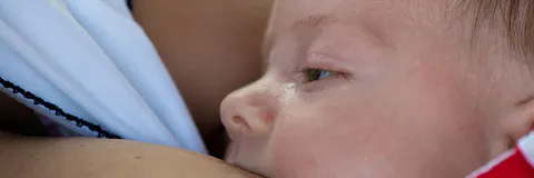 Severe Hypernatremic Dehydration in a Neonate