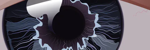 Glaucoma as a Neurodegenerative Disease