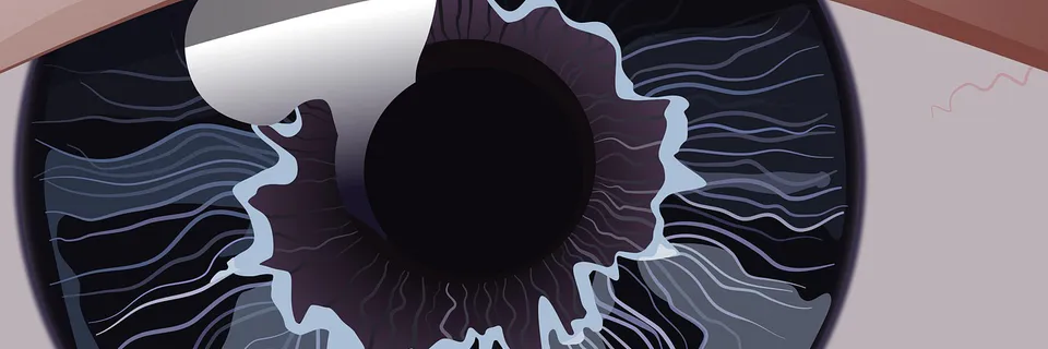 Glaucoma as a Neurodegenerative Disease Banner