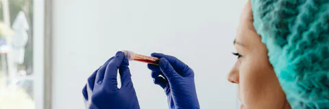 Serological Syphilis Testing in Brazilian Older Adults