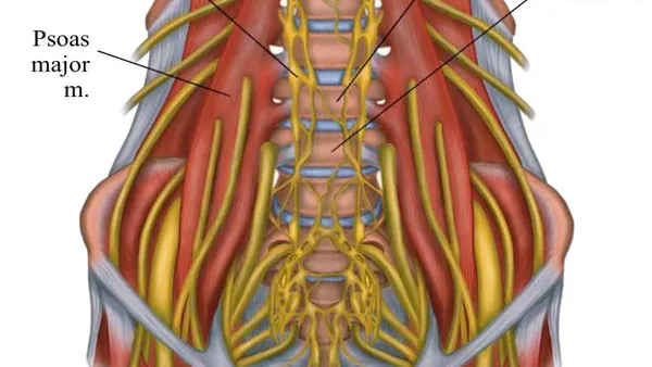 Laparoscopic Superselective Transperitoneal Lumbar Sympathectomy for Treating Plantar Hyperhidrosis