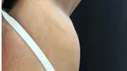 Feature