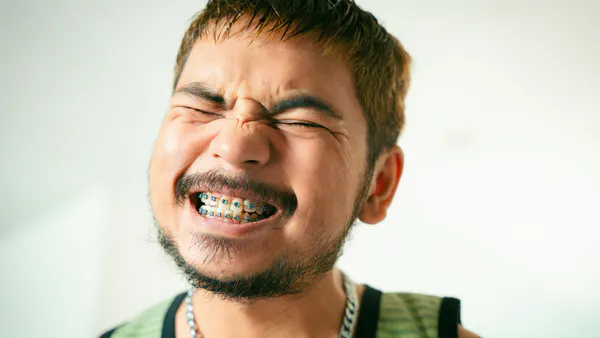 Impact of ICON on the Adhesive Microleakage Underneath Orthodontic Bracket