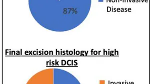 An Audit on the Role of Sentinel Lymph Node Biopsy (SLNB) in High Risk of Invasion DCIS and Encysted Papillary Carcinoma