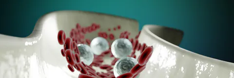 Indicators of Stroke Prediction Among Cardiac Patients