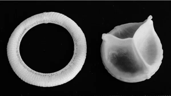 Eight Types of Interchangeable Prosthetic Heart Valve: A Mini Review.