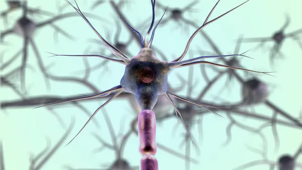 A Neural Networks and Rules Based System used to Find a Correlations, and Therefore Try to Maintain the State of Health, in Patient Affect by Multiple Sclerosis at the Origins of Well-Being at a Certain Time Daily Time with  Clinical and the Musculoskeletal Exams.