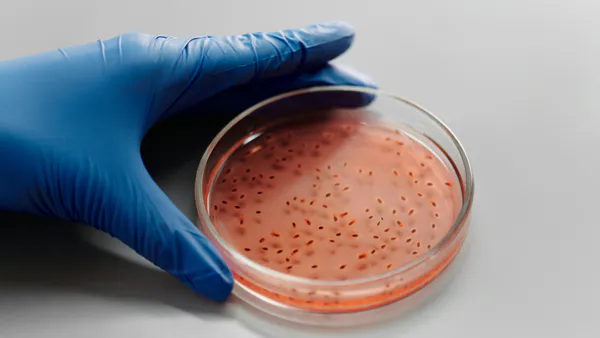 Comprehensive Review of Key Taenia Species and Taeniosis/Cysticercosis Disease in Animals and Humans