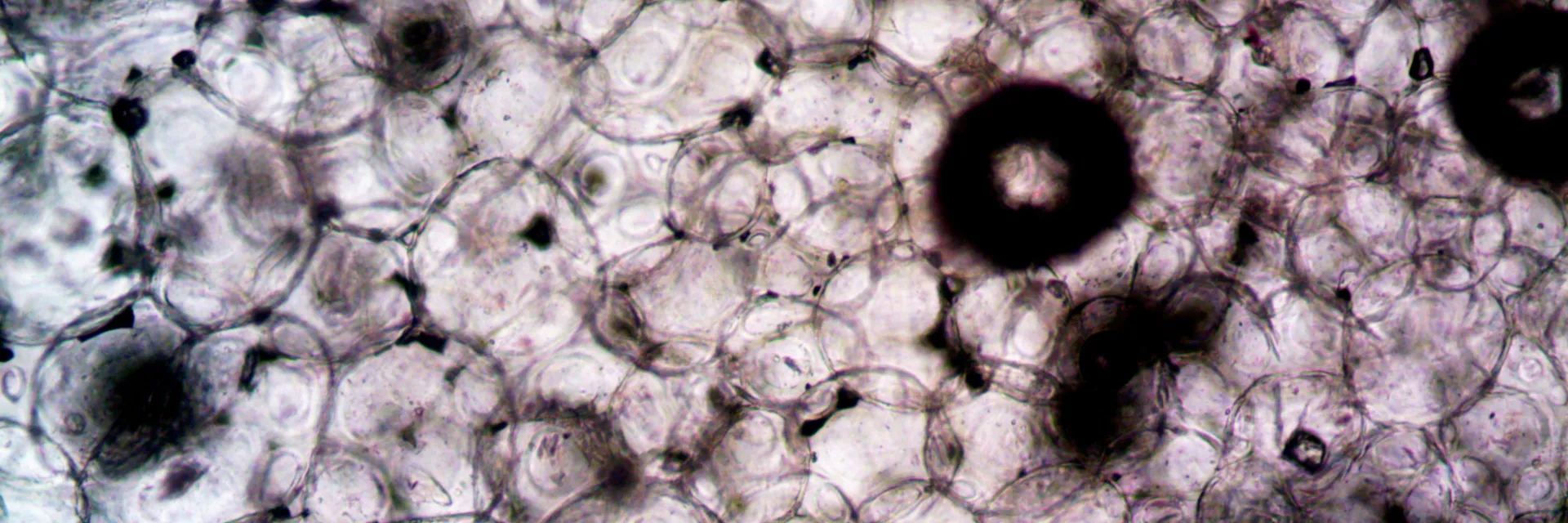 Review on Emulsomes as Carriers for Drug Delivery Banner