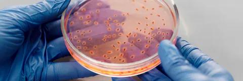 Plausibility Review on Lipoprotein(a) Infection Path of S2 Autoimmune Pathogen