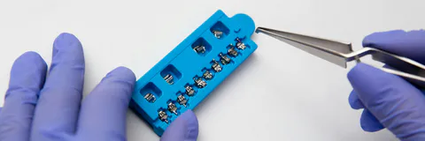 Extraction Treatment of Severe Bimaxillary Incisor Protrusion in a High-Angle Class II Patient: Three-Dimensional Torque Control Using ART and Ricketts Bioprogressive Mechanics