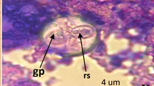 First Detection and Molecular Characterisation of Eimeria spp on Mugilidae fish Mugil cephalus Linnaeus, 1758 in Algerian Coast