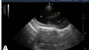 Evolution of Degenerative Myxomatous Mitral Valve Disease in a Canine Fox Terrier: A Case Report