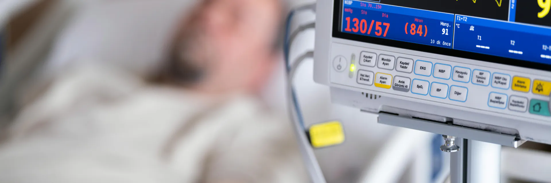 Intracranial Hypertension and the use of External Ventricular Drain – EVD: Correct Management Avoids Complications Banner