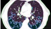 Feature