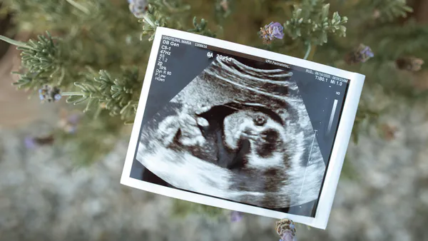 Amniotic Fluid Volume Disorders: Causes and Effects