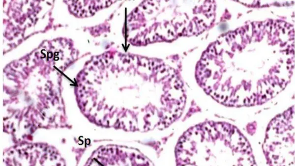 Biochemical Changes of Mancozeb-Induced AlteBiochemical Changes of Mancozeb-Induced Alternations in Testes and Thyroid gland of Male Ratsrnations in Testes and Thyroid gland of Male Rats