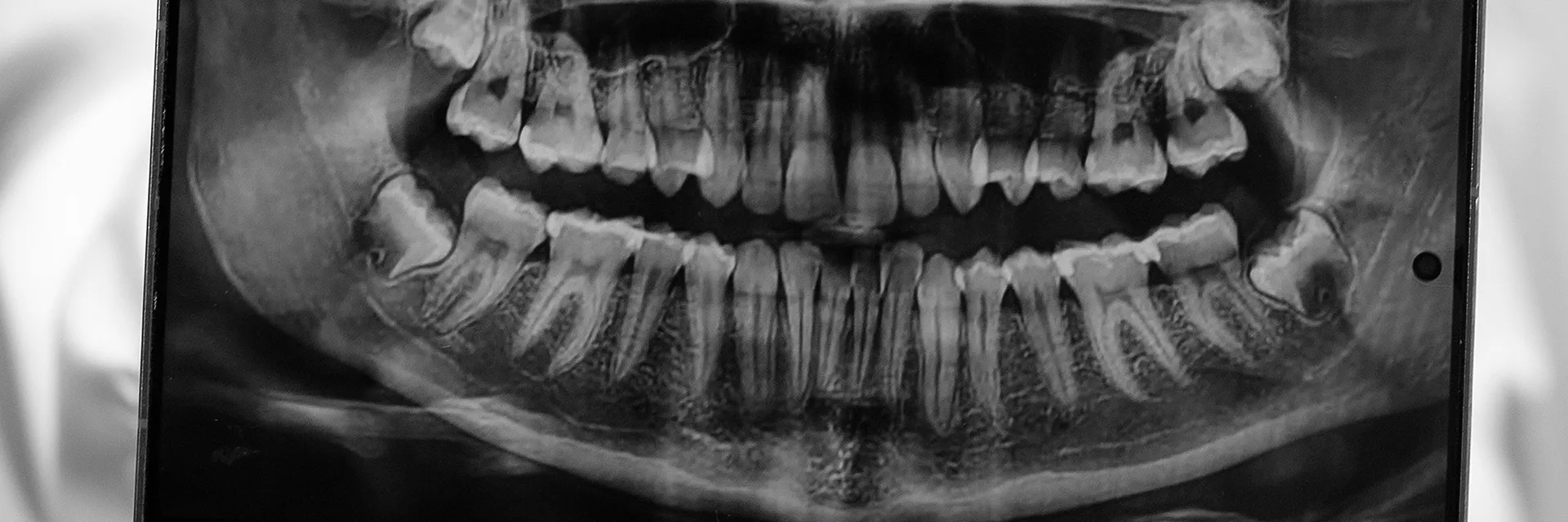 Covid-19 Quarantine and Dental Care: Patterns for Change Banner