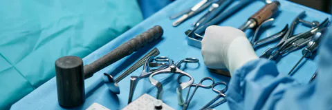 Incidental Finding of Perforated Jejunal Diverticulum during Laparotomy for Suspected Peritonitis on Peritoneal Dialysis Catheter: A Case Report